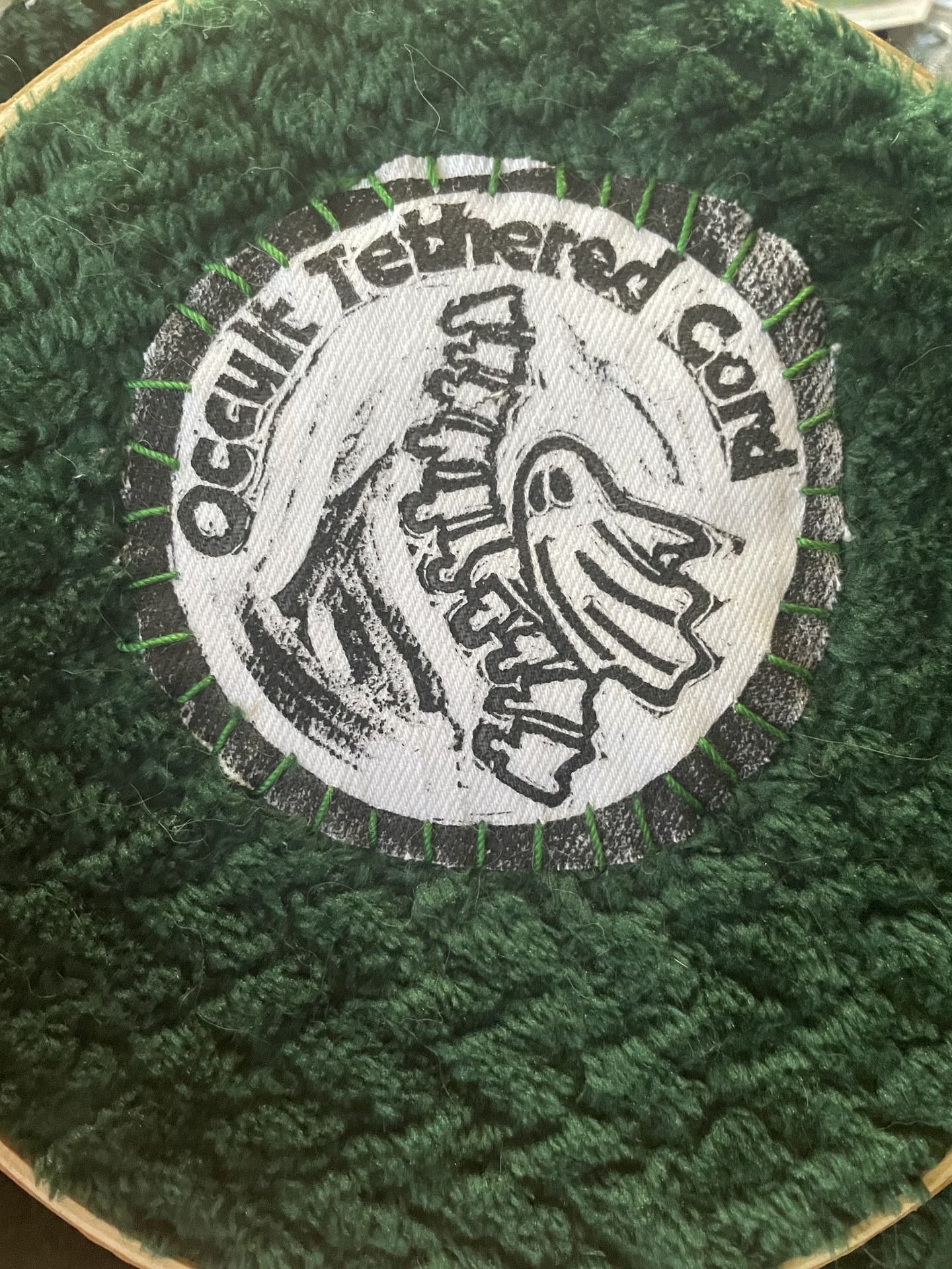 Occult Tethered Cord Patch