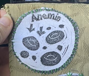 Anemia Patch
